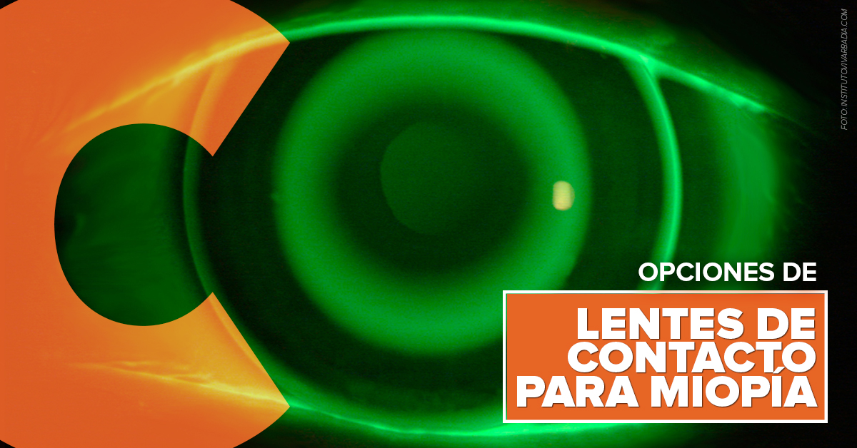 Opciones de lentes de contacto para miopía