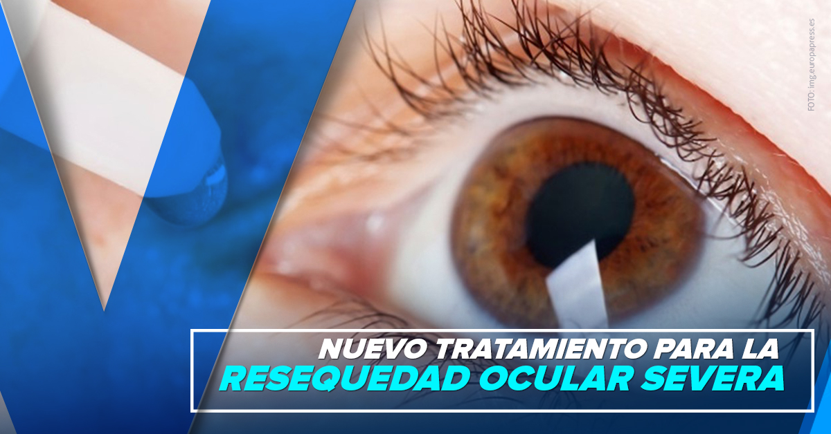 NUEVO TRATAMIENTO PARA LA RESEQUEDAD OCULAR SEVERA