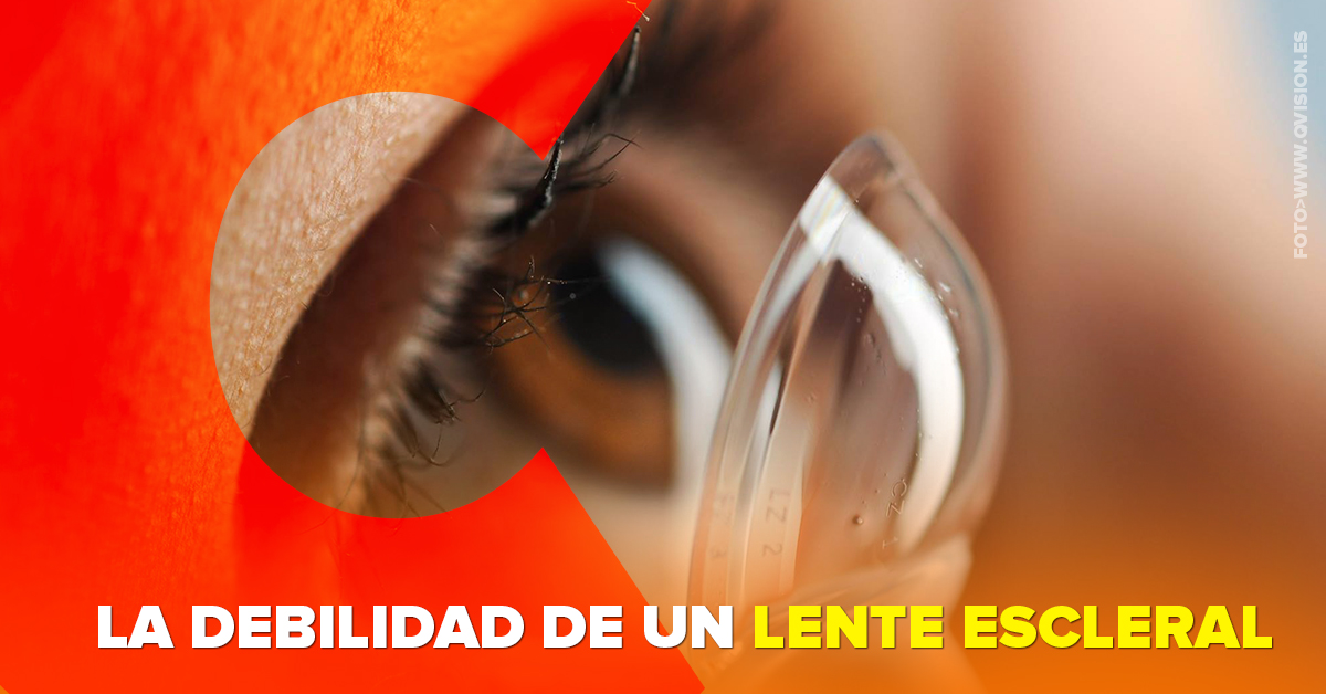 Uso de lentes esclerales