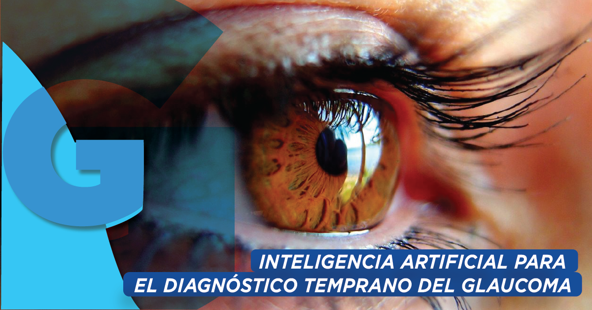 Inteligencia artificial para el diagnóstico temprano de glaucoma