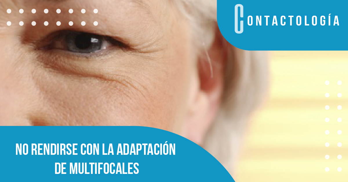 No rendirse con la adaptación de multifocales