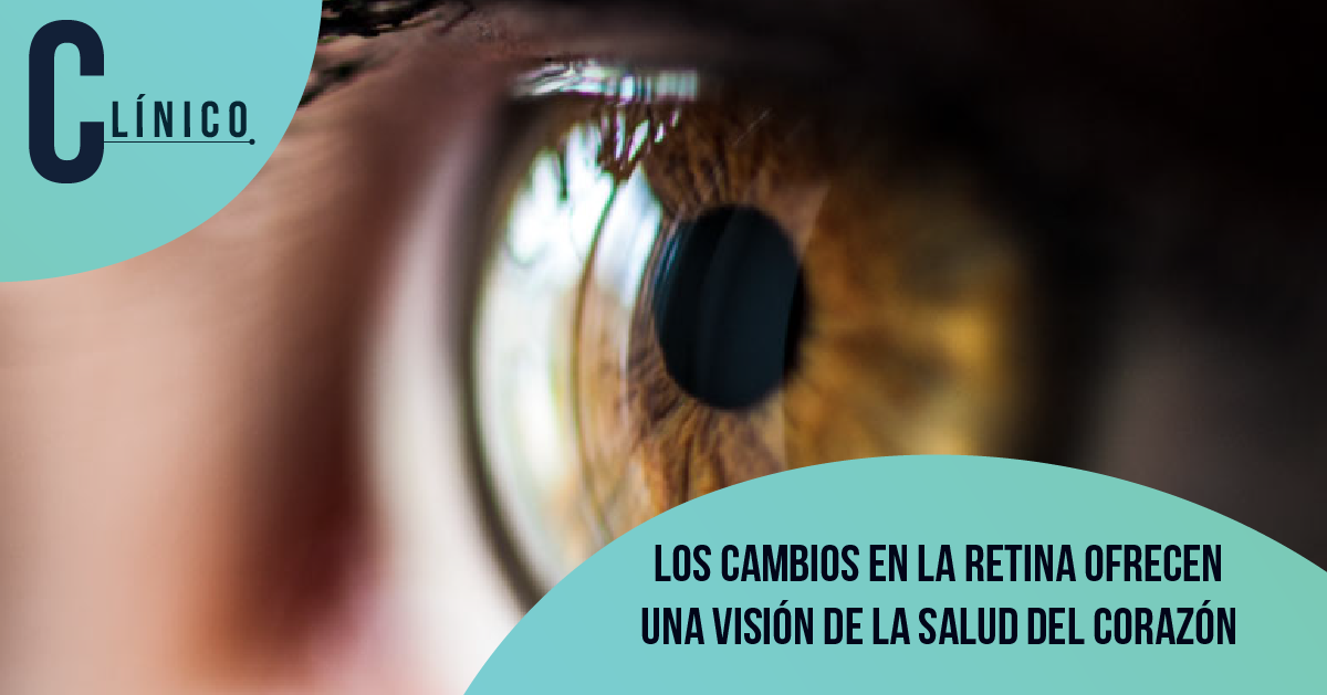 Los cambios en la retina ofrecen una visión de la salud del corazón