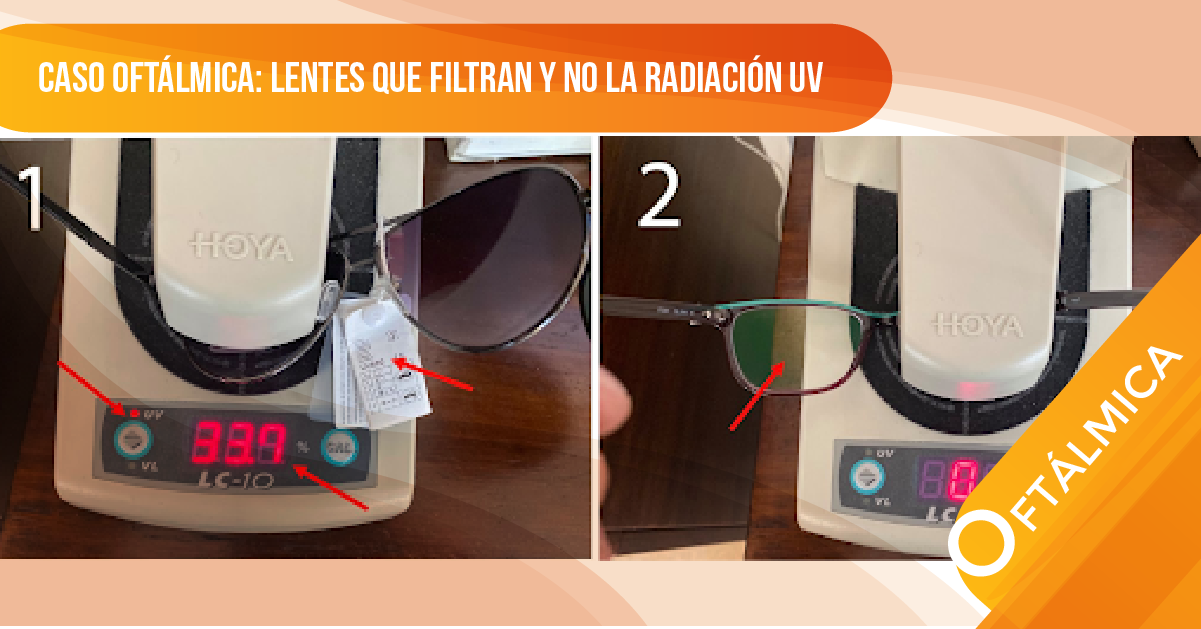 CASO OFTÁLMICA: LENTES QUE FILTRAN Y NO LA RADIACIÓN UV