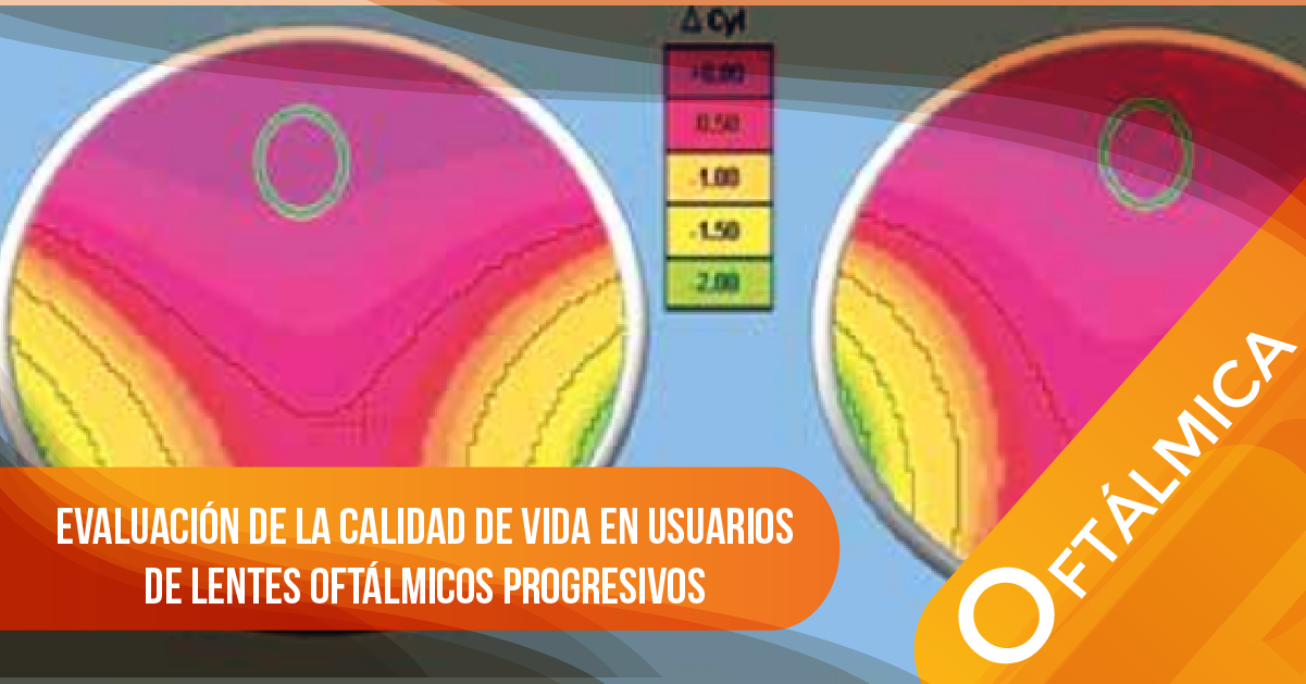 Evaluación de la calidad de vida en usuarios de lentes oftálmicos progresivos