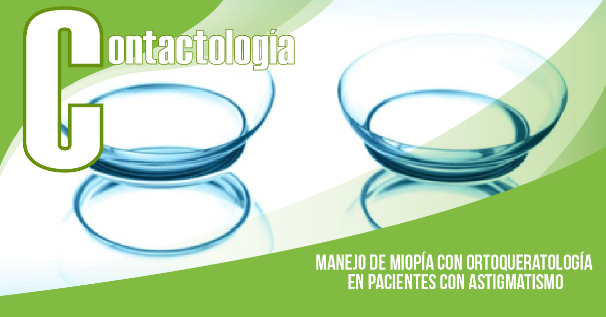 MANEJO DE MIOPÍA CON ORTOQUERATOLOGÍA EN PACIENTES CON ASTIGMATISMO