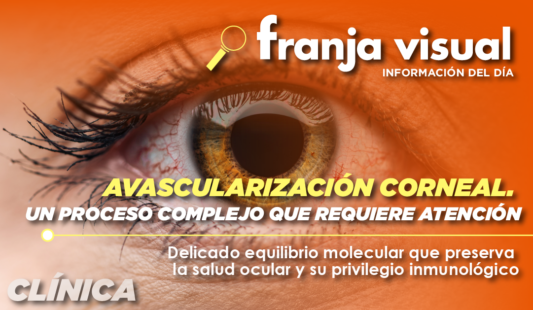 Avascularización corneal. Un proceso complejo que requiere atención