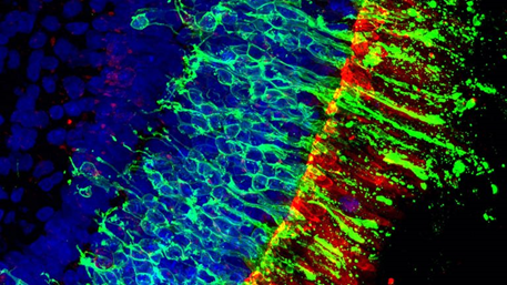 CIENTÍFICOS CREAN RETINAS HUMANAS FUNCIONALES