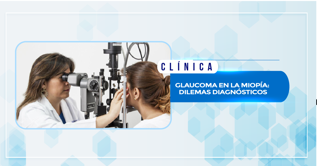 GLAUCOMA EN LA MIOPÍA: DILEMAS DIAGNÓSTICOS