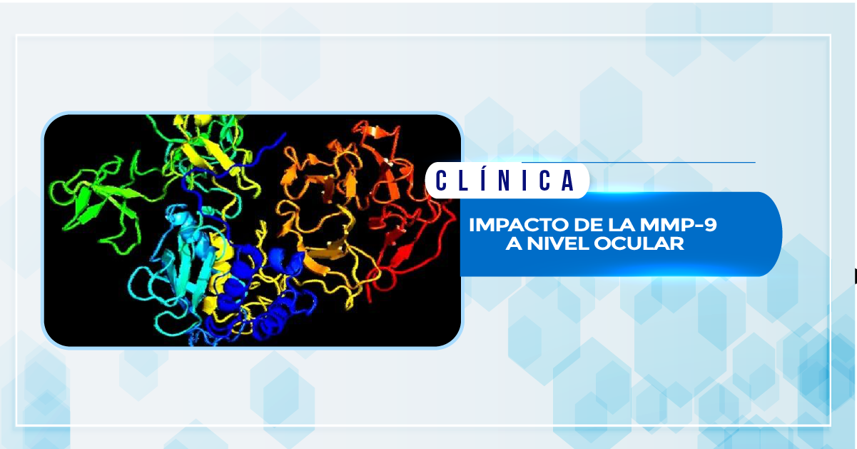 IMPACTO DE LA MMP-9 A NIVEL OCULAR