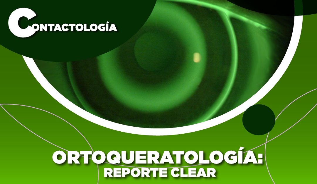 ORTOQUERATOLOGÍA: REPORTE CLEAR