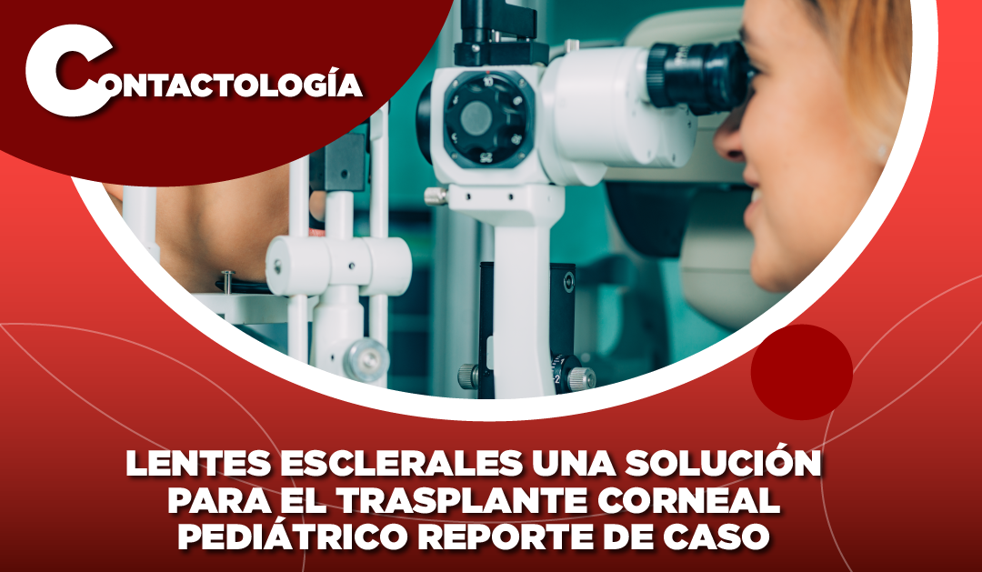 LENTES ESCLERALES UNA SOLUCIÓN PARA EL TRASPLANTE CORNEAL PEDIÁTRICO