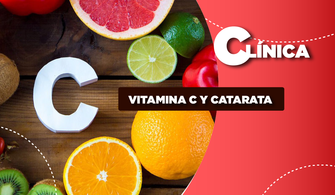 Vitamina C y catarata