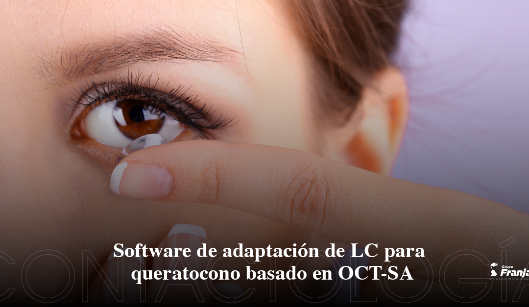 Software de adaptación de LC para queratocono basado en OCT-SA