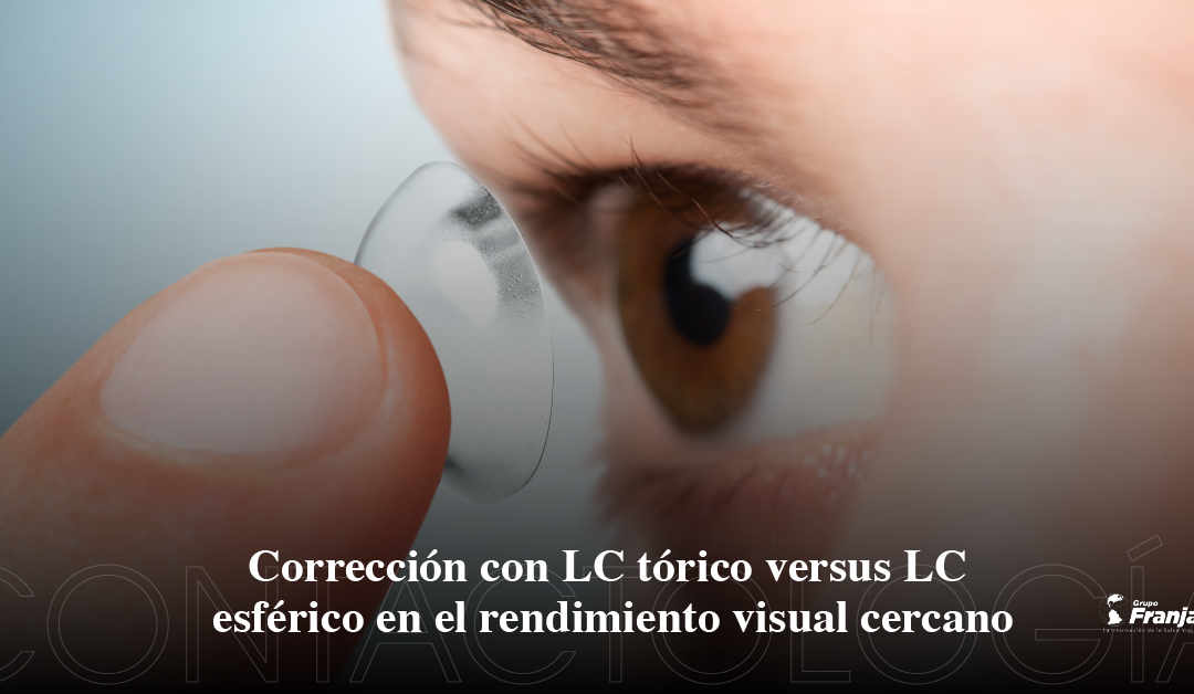Corrección con LC tórico versus LC esférico en el rendimiento visual cercano