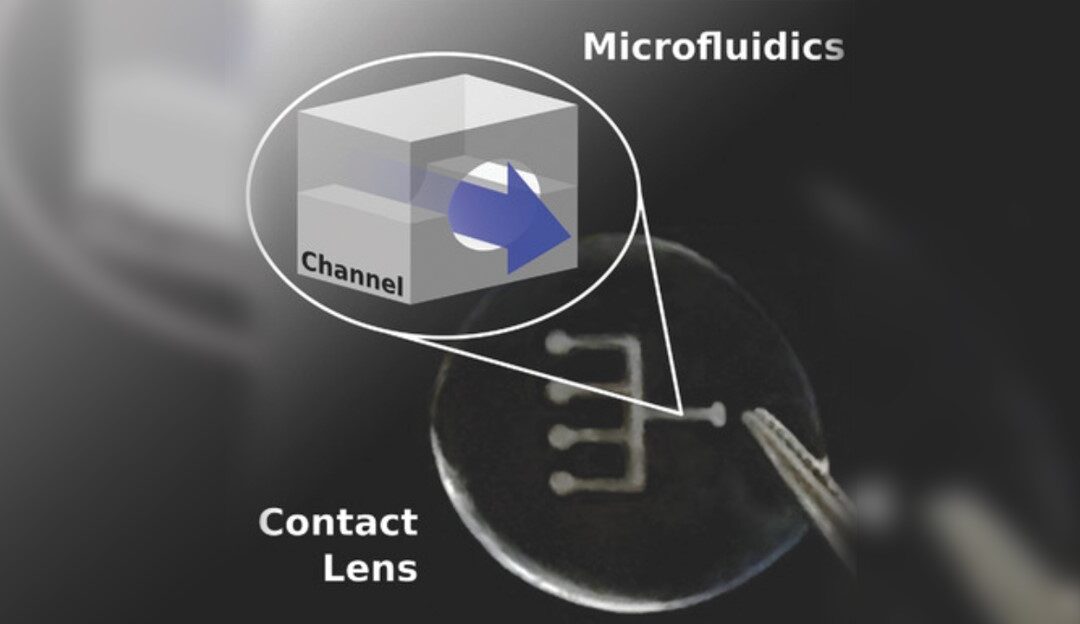 Lente de contacto microfluídico para abordar el ojo seco inducido por lentes de contacto