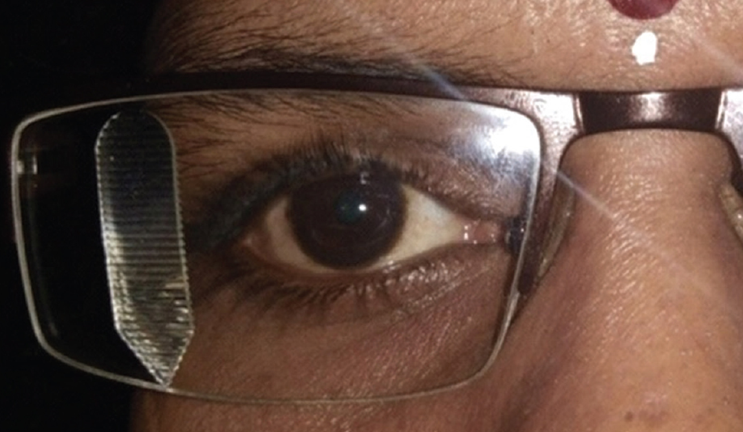 Lentes prismáticos para pacientes con glaucoma