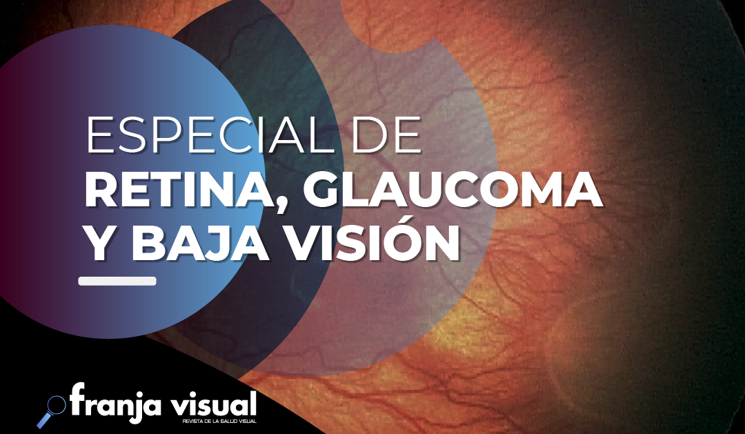 Especial de Retina, Glaucoma y Baja Visión