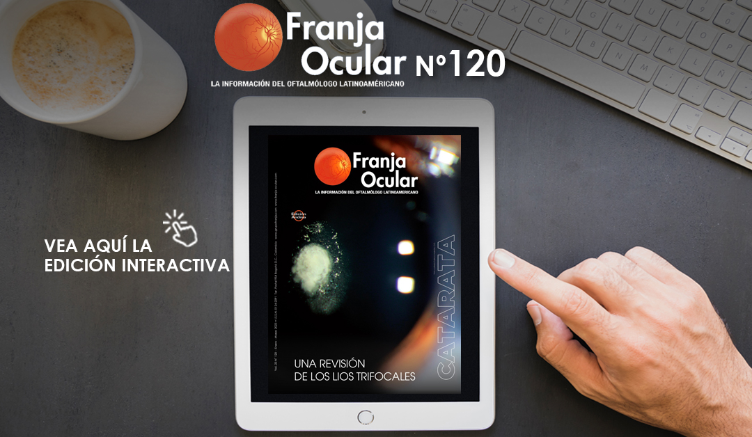 Franja Ocular 120