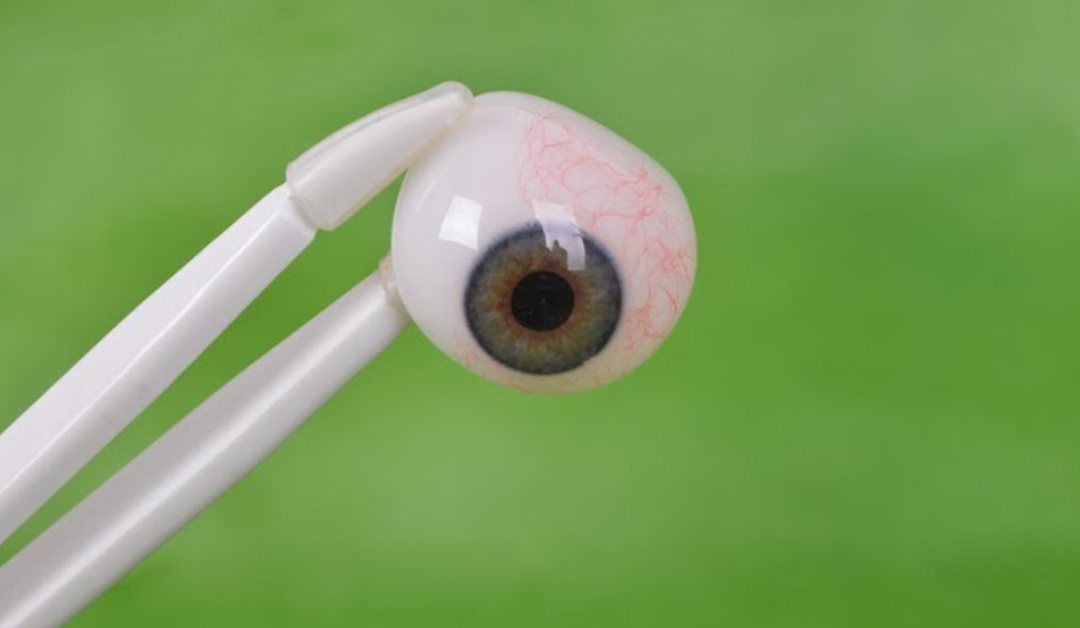 Tecnología 3D para pacientes con pérdida ocular