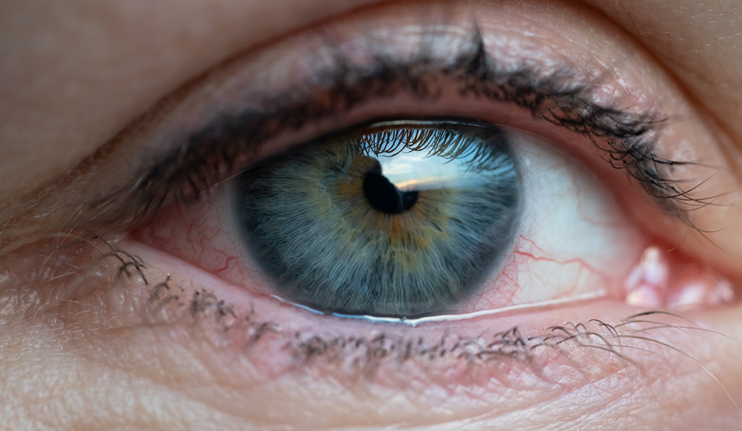 El ojo y la enfermedad autoinmune: más allá de una xerostomía