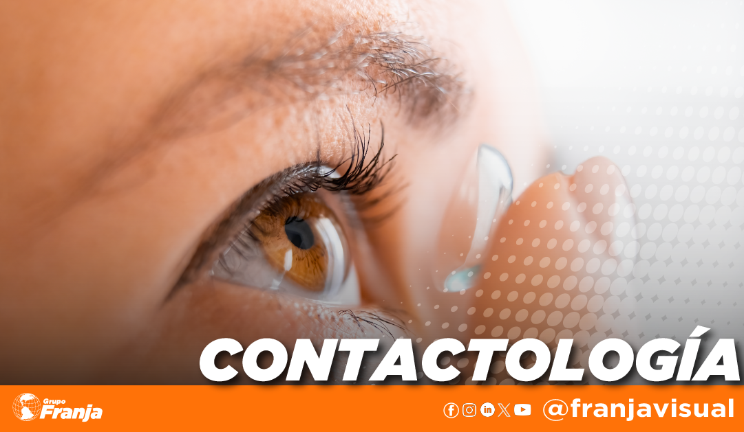 Lentes de contacto hidrofílicos hot sale