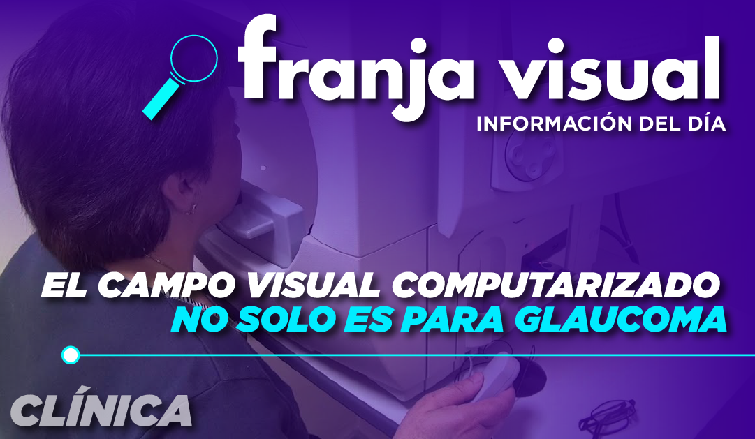 El campo visual computarizado no solo es para glaucoma