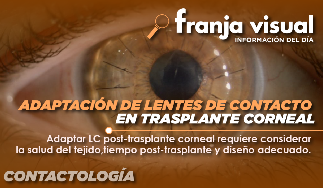 Adaptación de lentes de contacto en trasplante corneal