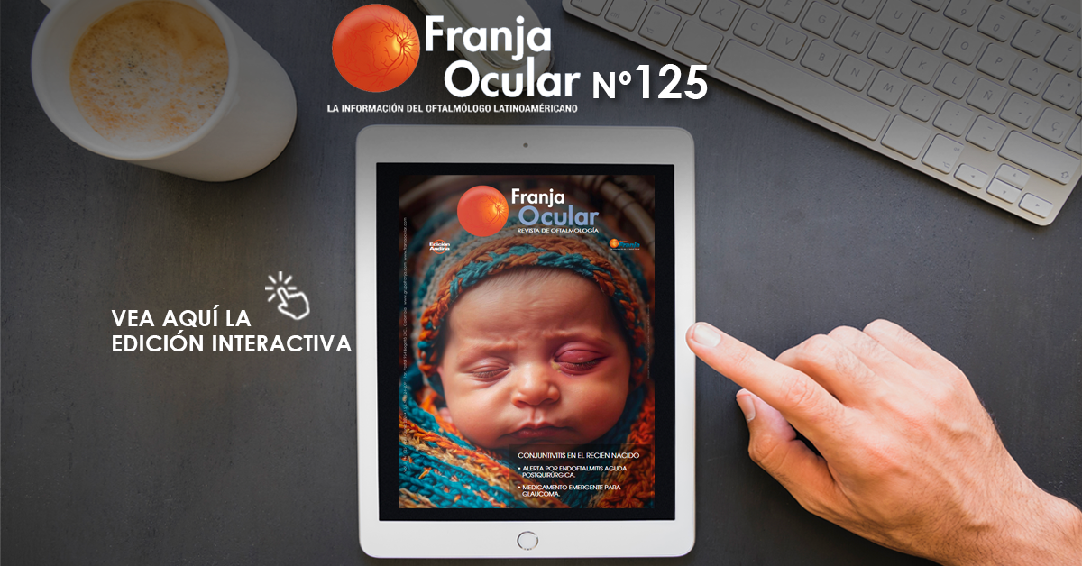 Revista Franja Ocular 125