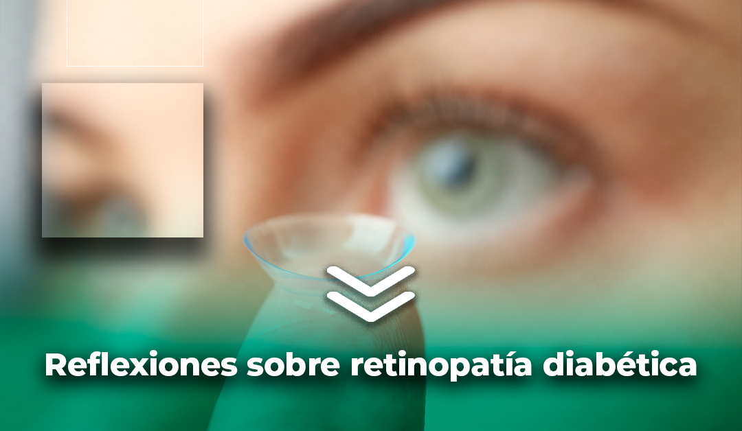 Boletín semanal: Reflexiones sobre retinopatía diabética