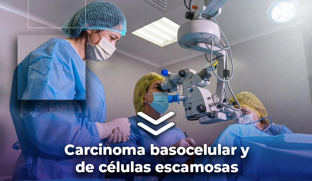 Boletín semanal: Carcinoma basocelular y de células escamosas