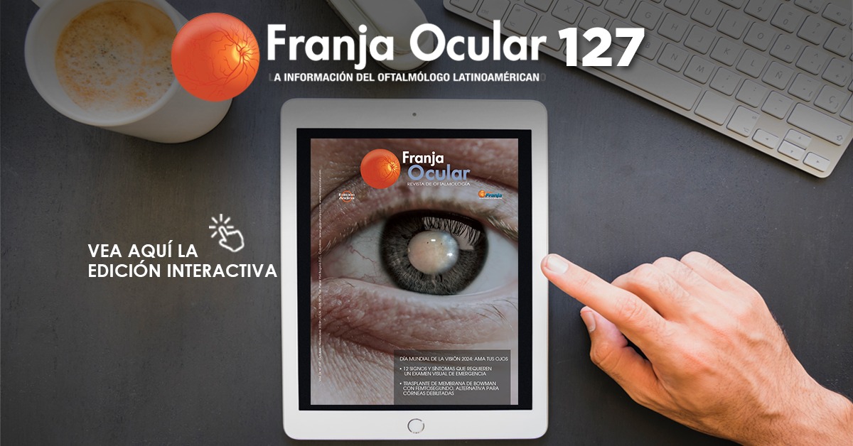 Revista Franja Ocular 127