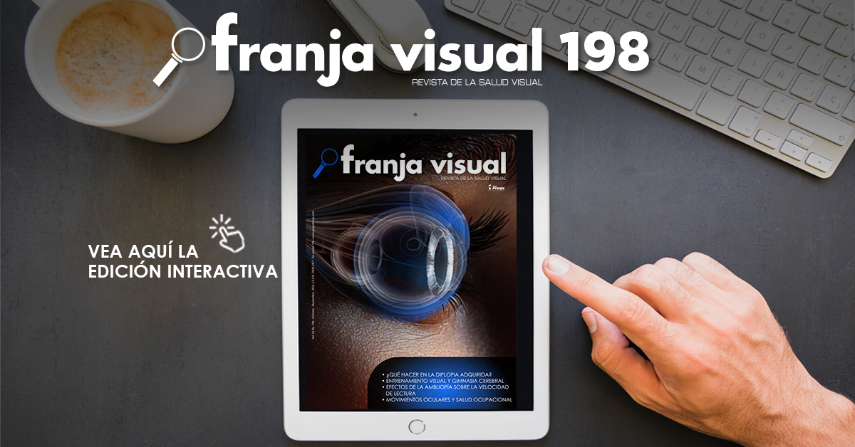 Franja Visual 198