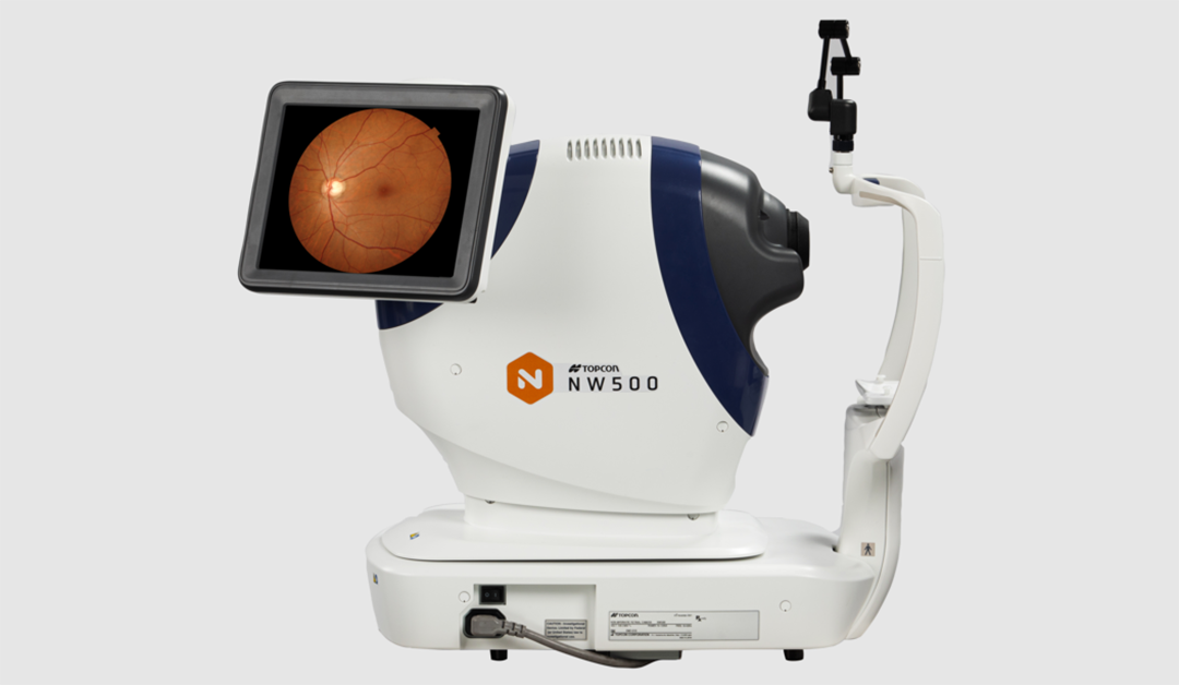 Conozca la cámara retinal robótica no midriática NW500 de Topcon