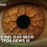 TFOS DEWS III: Enfoque Actual para el Manejo del Ojo Seco.
