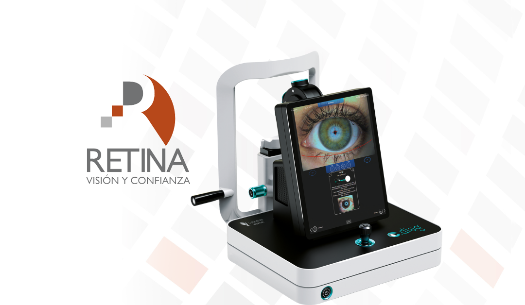 Retina logo reading 'Visión y Confianza' beside a retinal imaging device displaying a close-up blue eye.