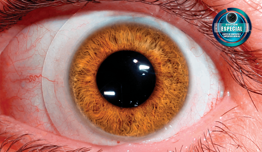 Close-up of a brown-orange iris and black pupil, with visible red veins in the sclera; a blue 'Special Edition' badge sits in the top-right corner.