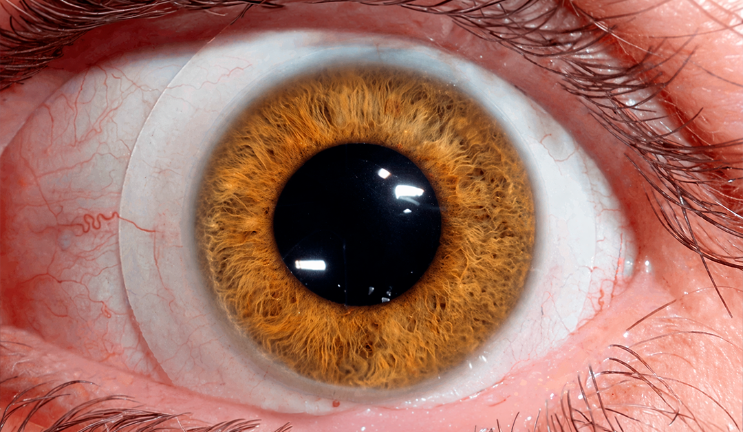 Close-up of a brown hazel iris and pupil in a macro shot of a human eye, showing intricate iris texture and red vascular sclera detail.
