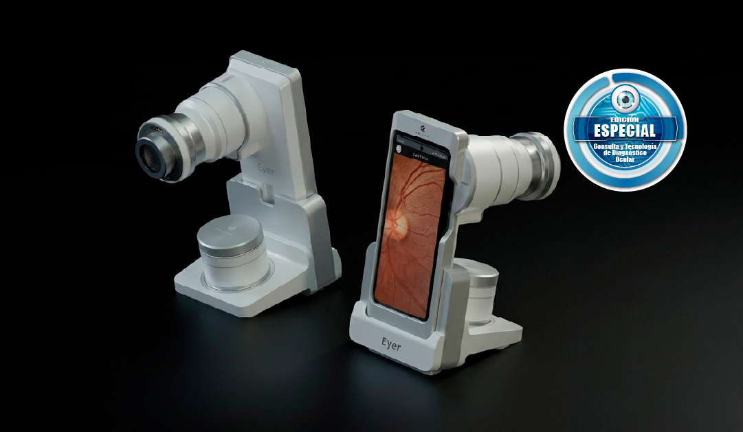 Two Eyer retinal imaging devices on a black background, one with a smartphone display showing a fundus image, for eye examination.