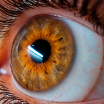 Perfil periférico del lc escleral y edema corneal
